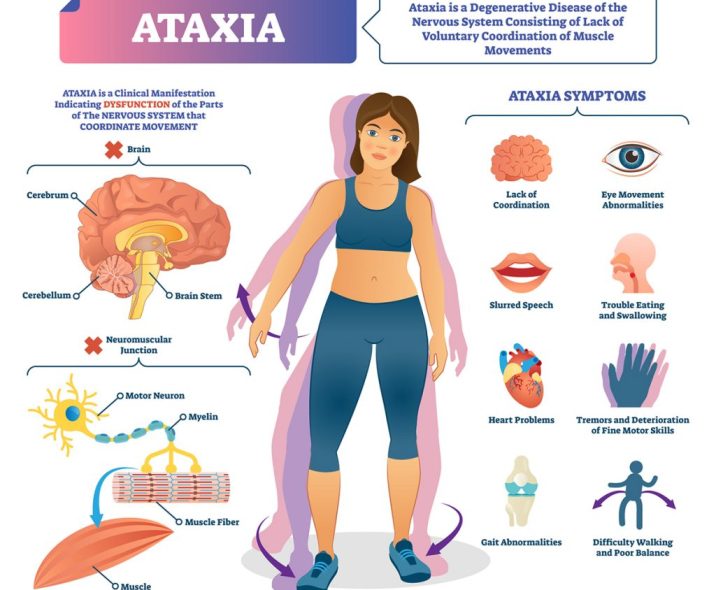 ataxia-illustration-1200x1200-1024x1024
